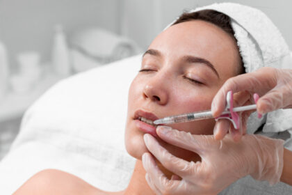 Microneedling for Acne Scar Treatment